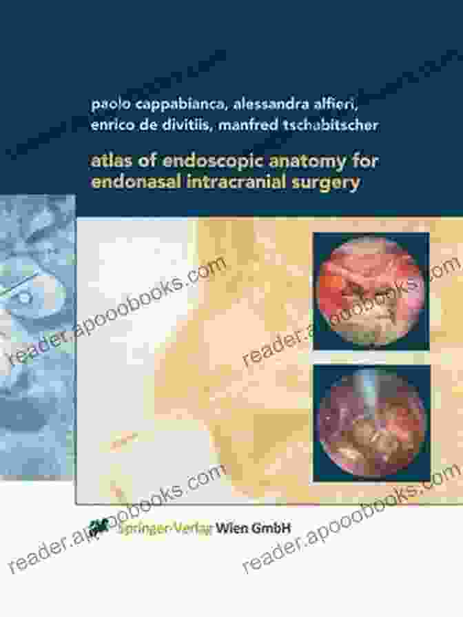 Atlas of Endoscopic Anatomy for Endonasal Intracranial Surgery