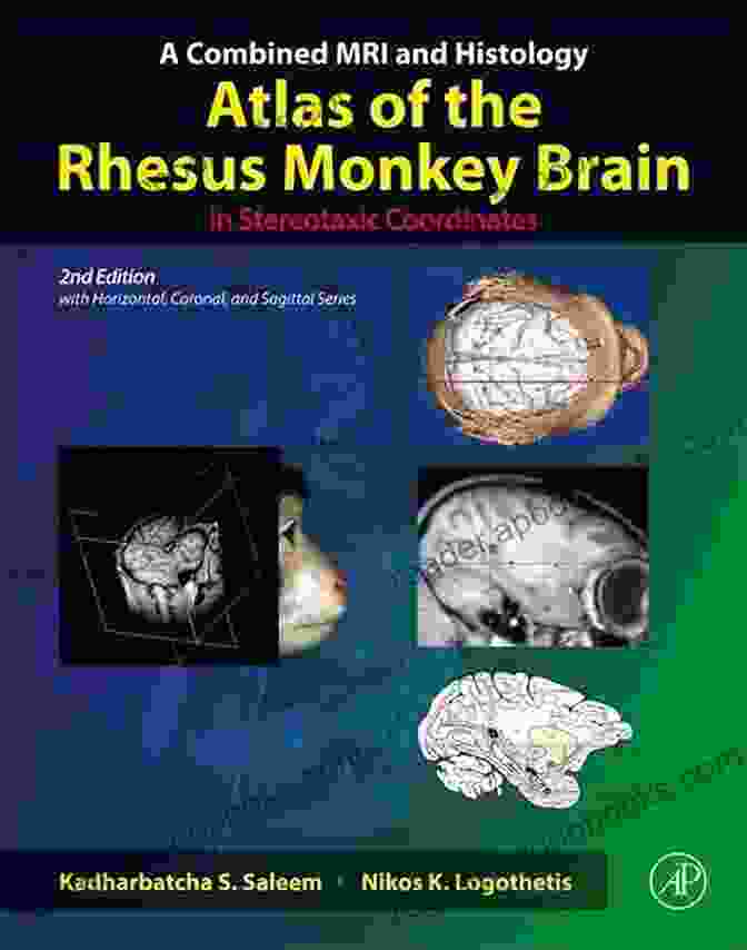 Combined MRI And Histology Atlas Of The Rhesus Monkey Brain In Stereotaxic Coordinates A Combined MRI And Histology Atlas Of The Rhesus Monkey Brain In Stereotaxic Coordinates