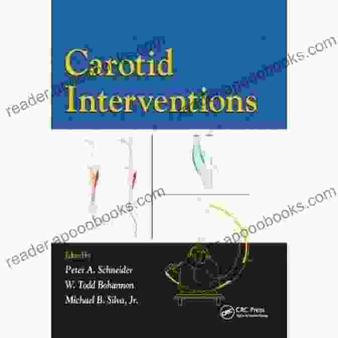 Cover Of The Book 'Carotid Interventions' By Kenneth Doka Carotid Interventions Kenneth J Doka