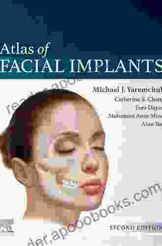 Atlas of Facial Implants Michael J Yaremchuk