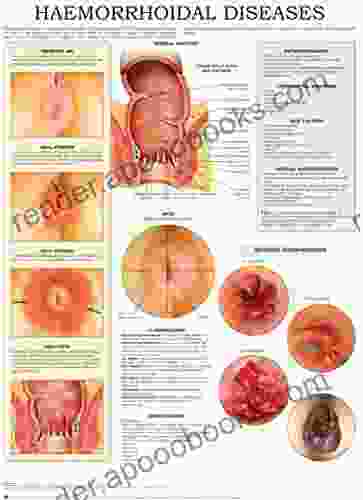 Haemorrhoidal Diseases e chart: Quick reference guide