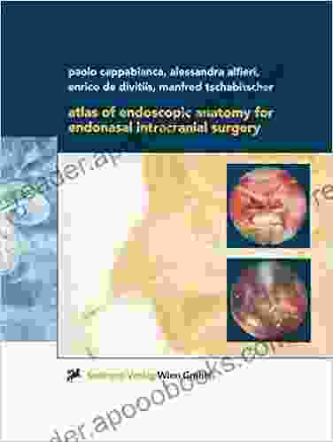 Atlas Of Endoscopic Anatomy For Endonasal Intracranial Surgery