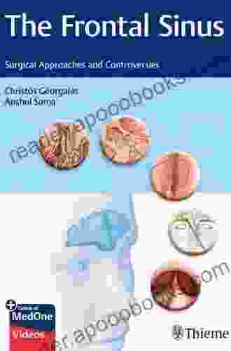 The Frontal Sinus: Surgical Approaches And Controversies