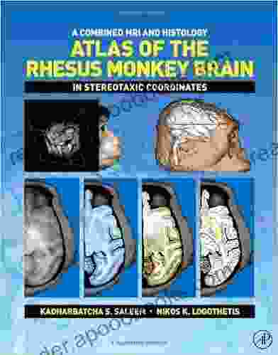 A Combined MRI And Histology Atlas Of The Rhesus Monkey Brain In Stereotaxic Coordinates